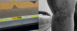 Platform Gap Accident in Seoul Subway